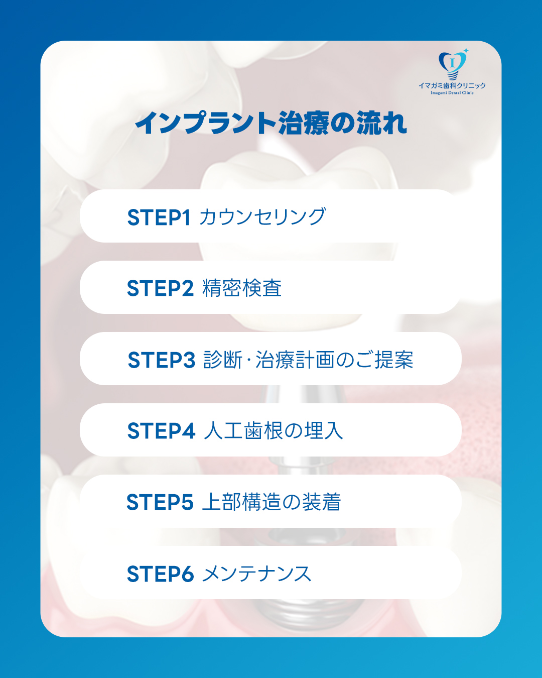 IDCインプラント