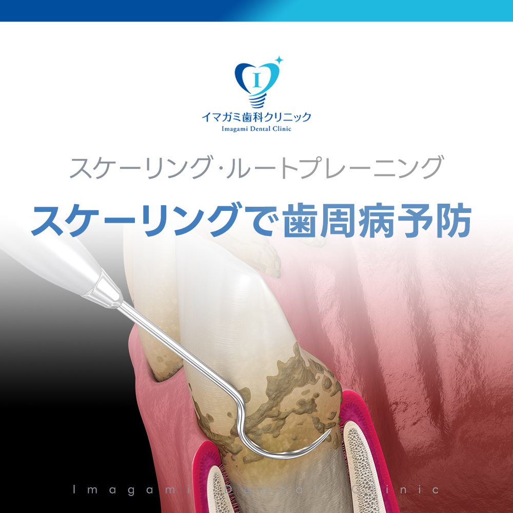 上本町 歯科