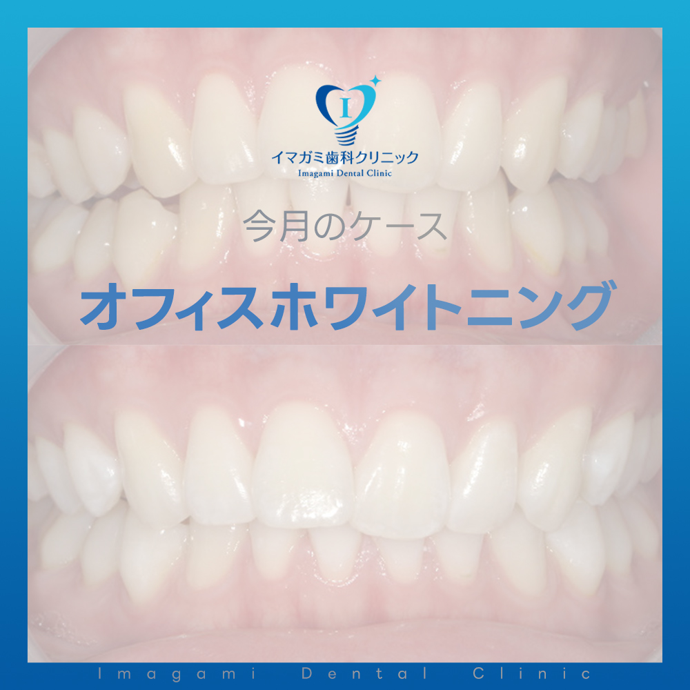 上本町 歯医者